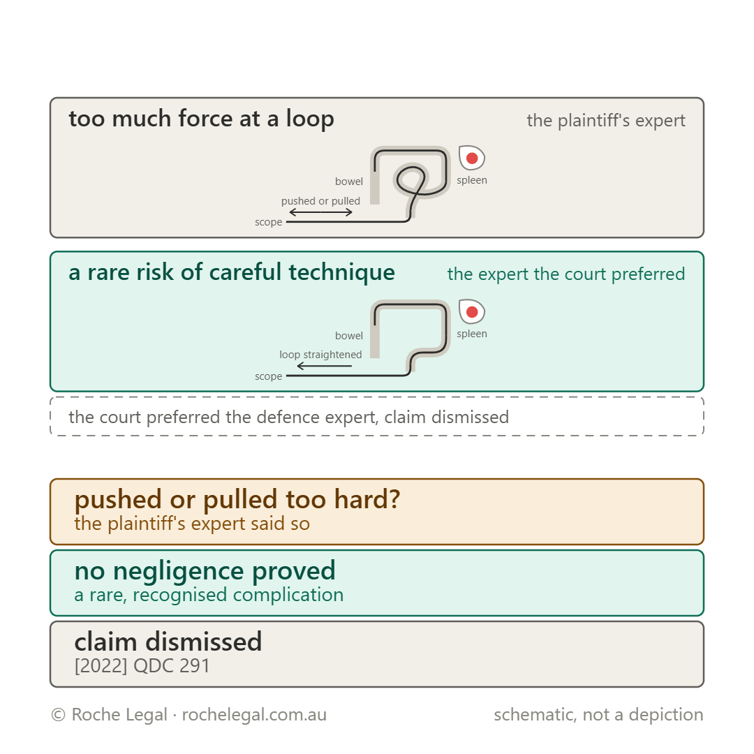 Schematic of Coulon v Adams [2022] QDC 291, a difficult colonoscopy, then a ruptured spleen