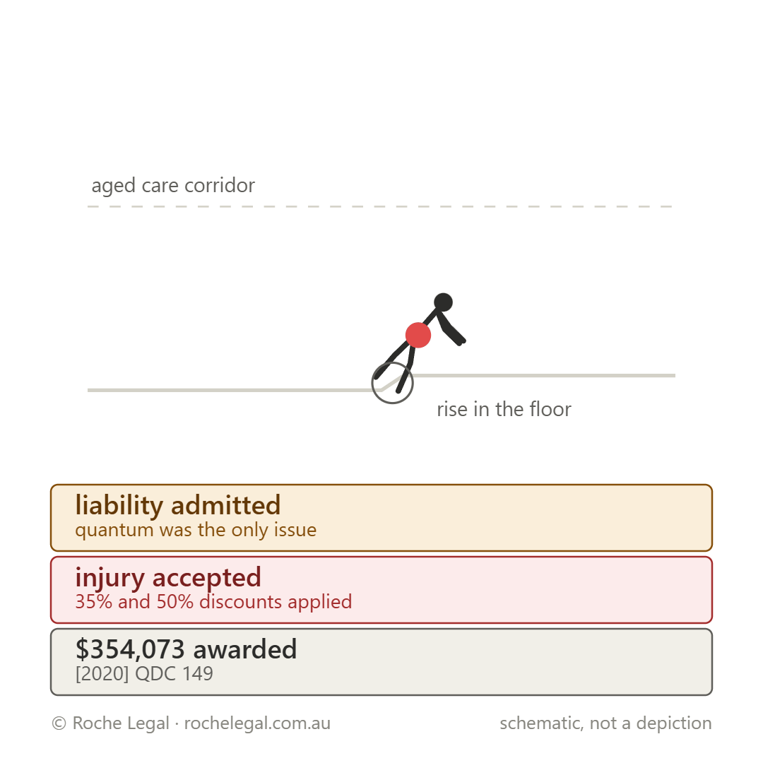 Schematic of Pearce v Prescare [2020] QDC 149, stumbled on a rise in the corridor floor